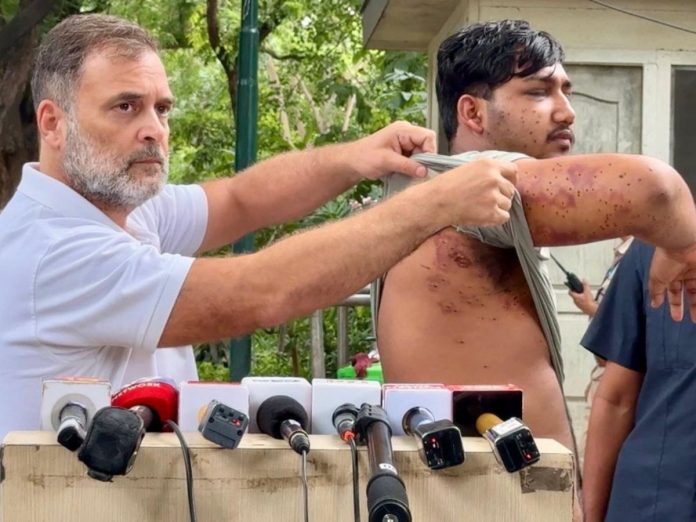 rahul gandhi press conference with a student claimed usage of pallet gun, राहुल गांधी